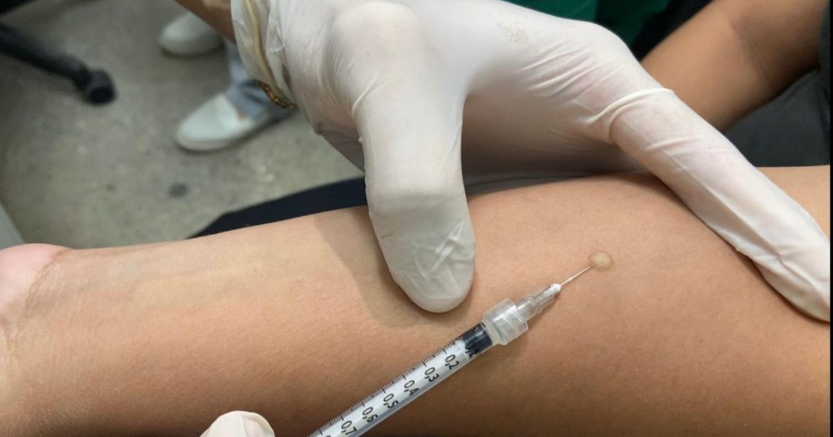 Contatos de casos ativos estão entre públicos indicados ao PPD em Manaus